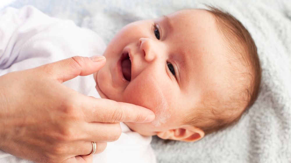 tips tegen eczeem bij kinderen tips bi jbaby eczeem